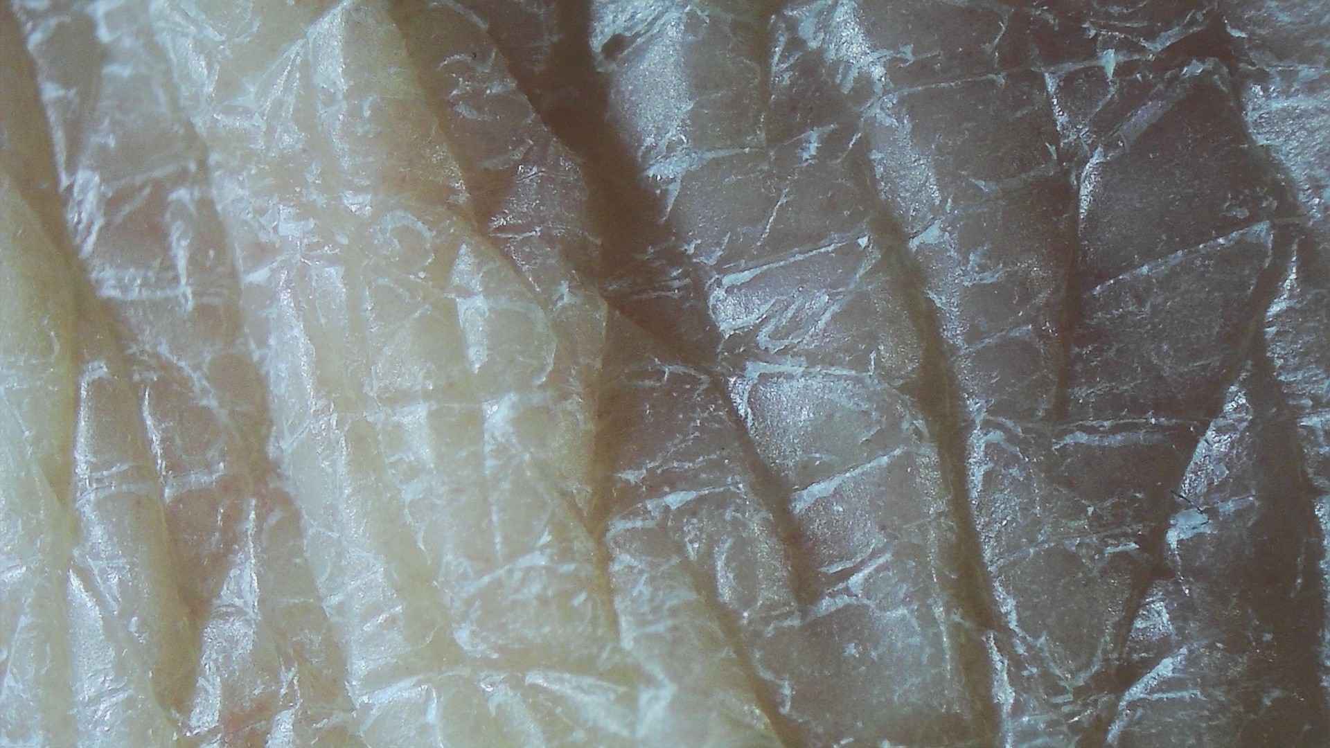 Close-up photograph of dry skin on an adult hand.